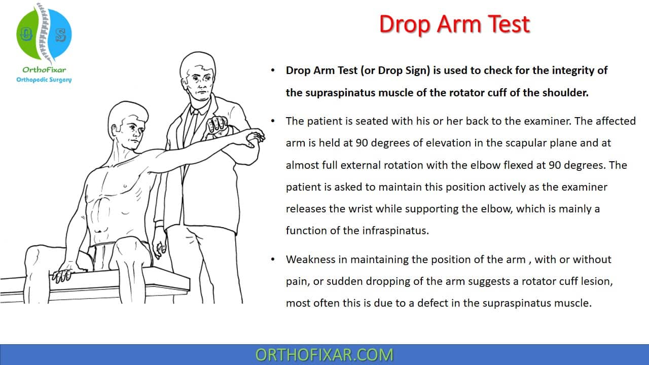  Drop Arm Test for Supraspinatus Tear 