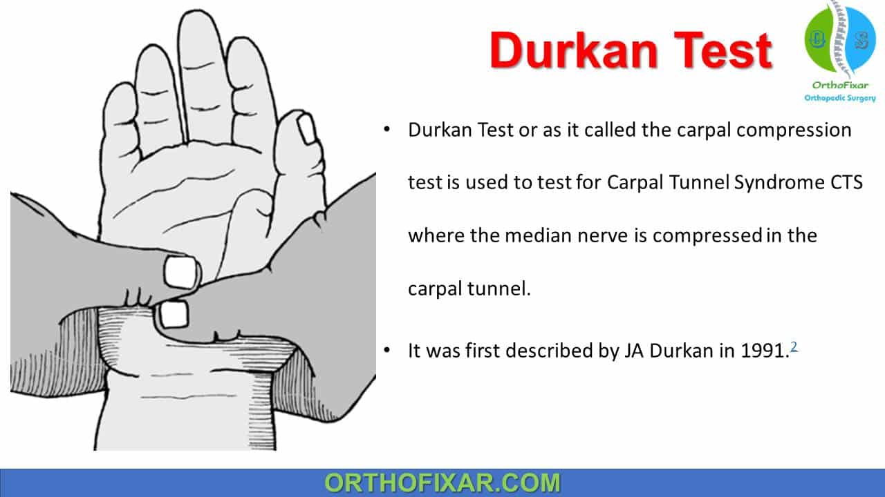  Durkan Test For Carpal Tunnel Syndrome 