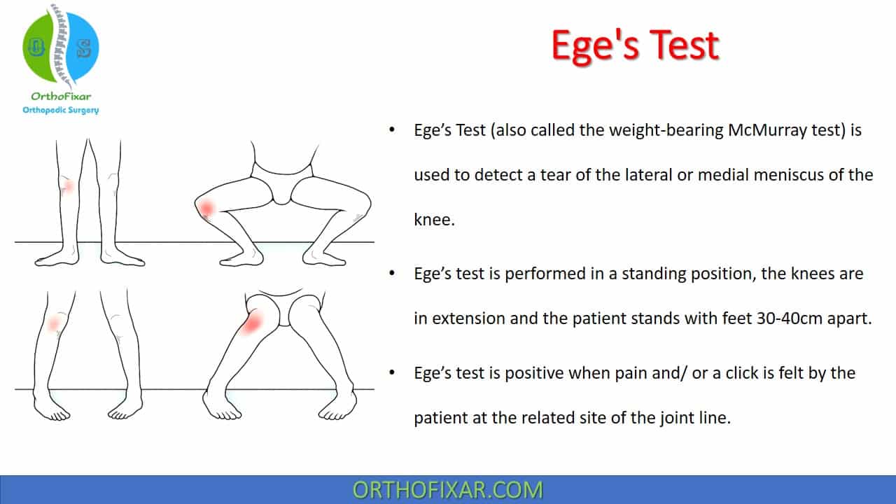  Ege’s Test | Weight-Bearing McMurray Test 