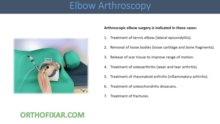 Elbow Arthroscopy