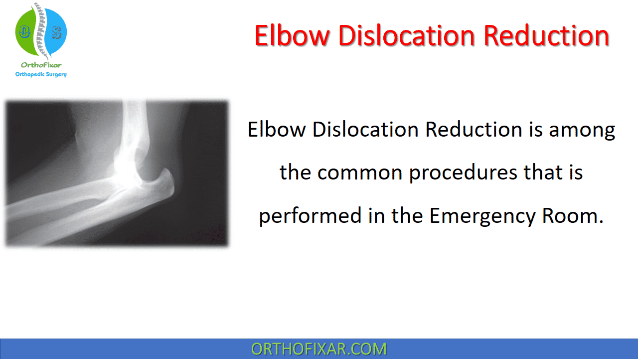  Elbow Dislocation Reduction 