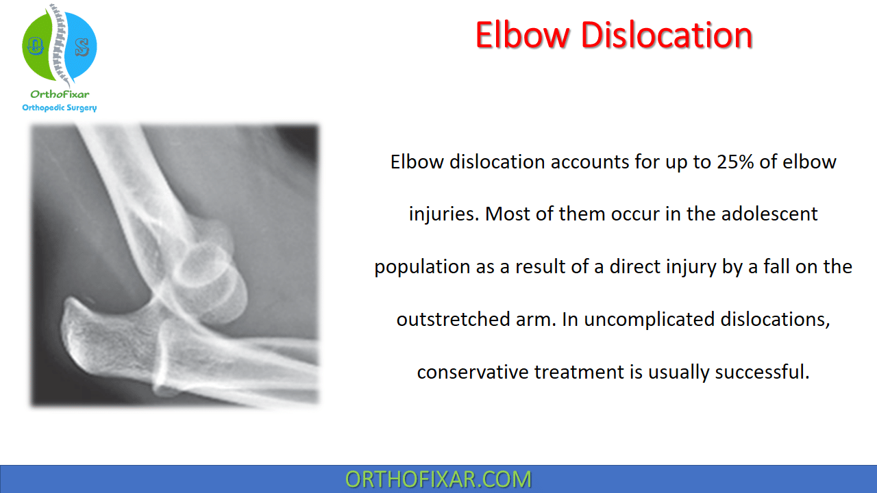 posterior elbow dislocation