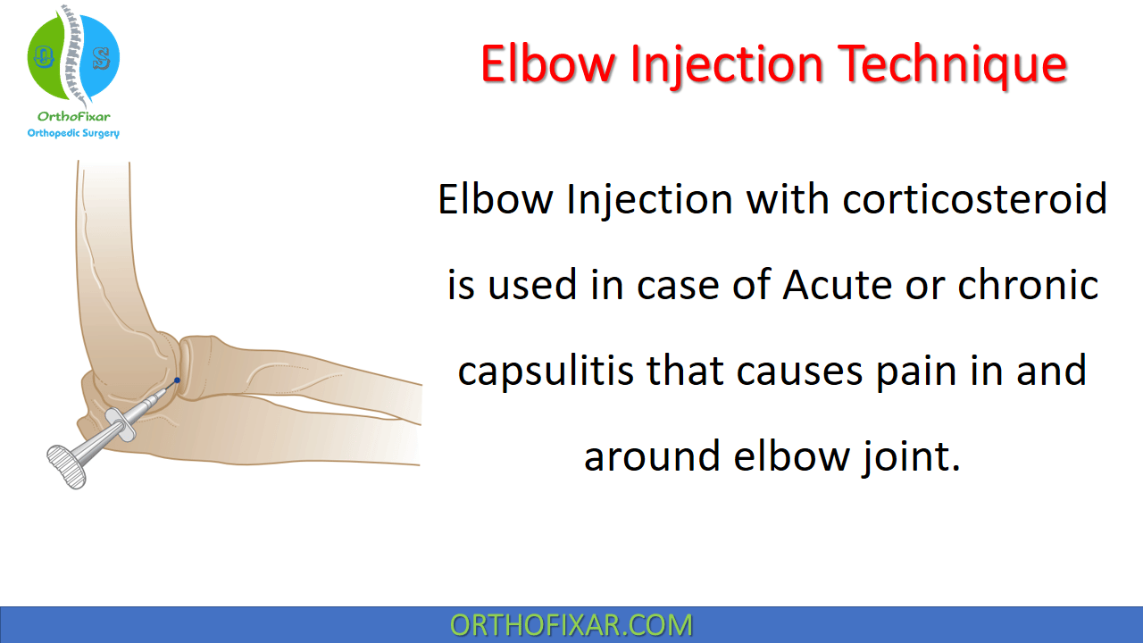  Elbow Injection Technique 