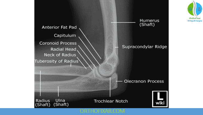 Elbow X-ray Views 2 Elbow Lateral View