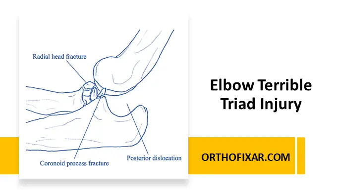 Elbow Terrible Triad Injury