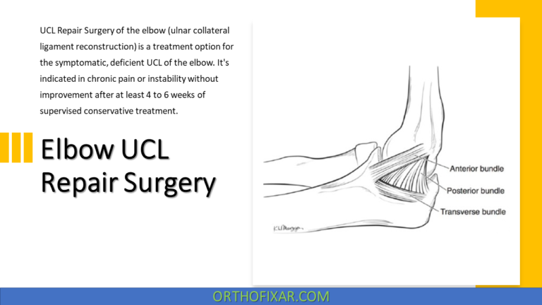 Elbow UCL Repair Surgery