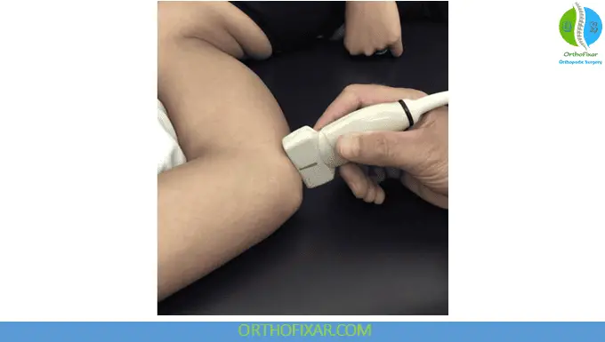 Elbow Ultrasound - Evaluation of the ulnar nerve
