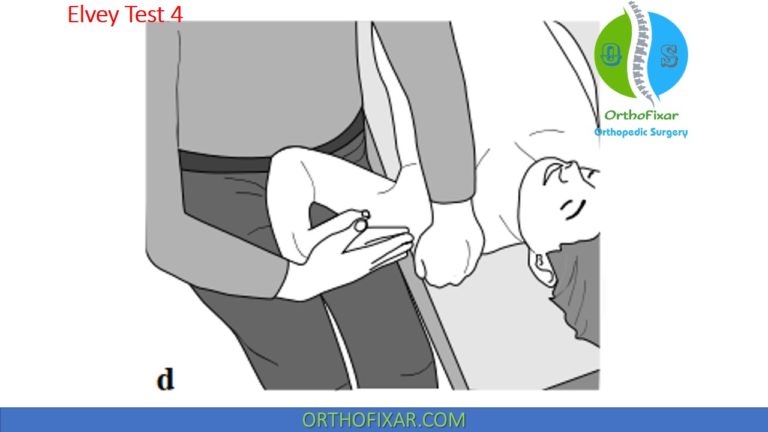 Ultt Numbers Elvey Test (ULTT): Upper Limb Tension Tests For Cervical Radiculopathy