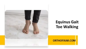 Equinus Gait Toe Walking