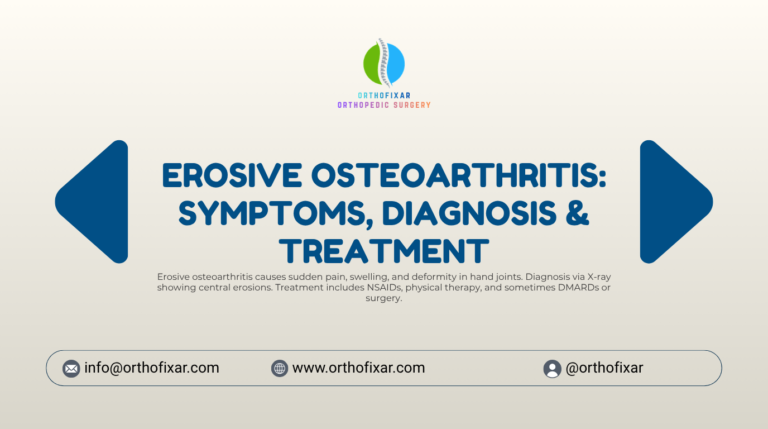 erosive osteoarthritis