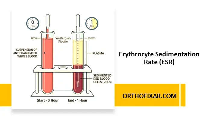 Erythrocyte Sedimentation Rate (ESR)