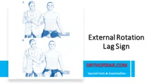 External Rotation Lag Sign