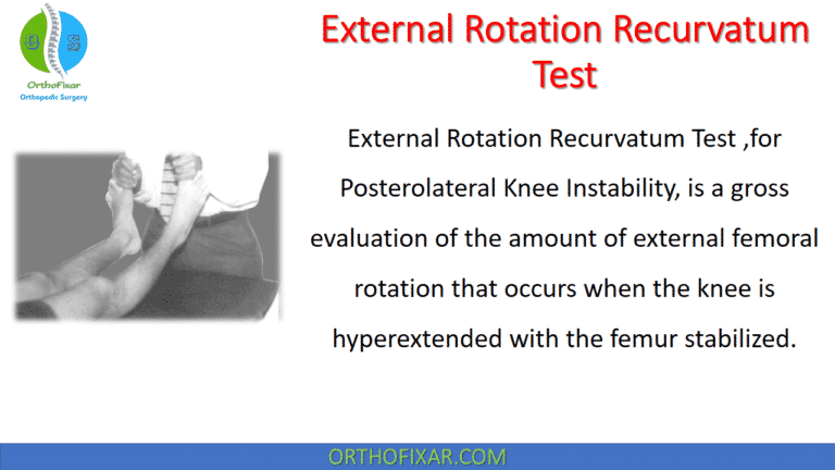 External Rotation Recurvatum Test