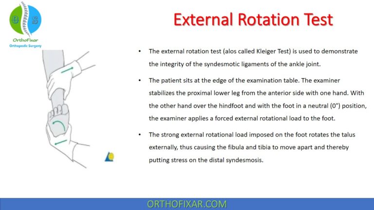 External Rotation Test