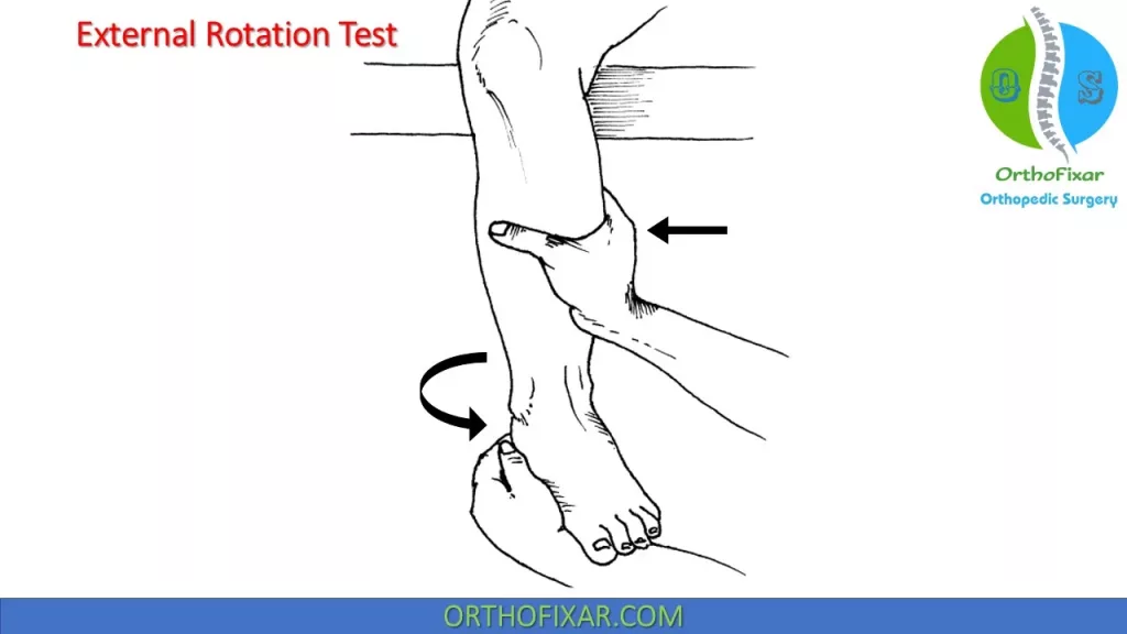 External Rotation Test