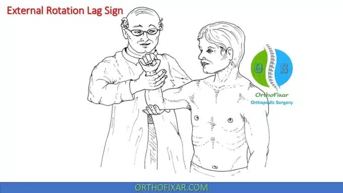 External rotation lag sign (3)