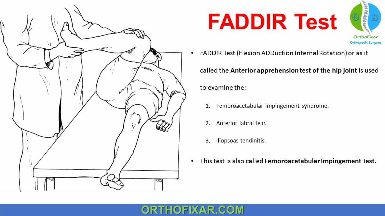  FADDIR Test for Hip 