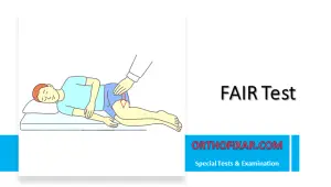 FAIR Test (Flexion, Adduction, and Internal Rotation Test)