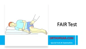 FAIR Test (Flexion, Adduction, and Internal Rotation Test)