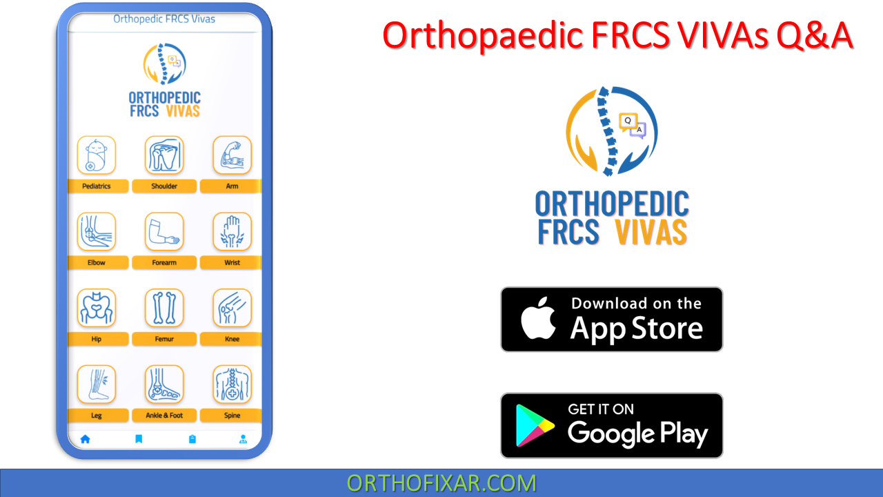  Orthopaedic FRCS VIVAs Q&A 
