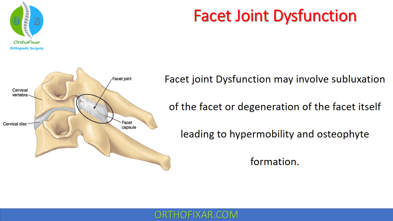  Facet Joint Dysfunction 