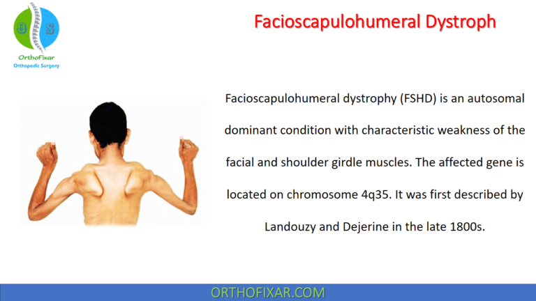 Facioscapulohumeral Dystrophy