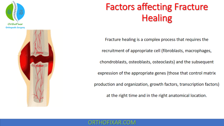 Factors affecting Fracture Healing