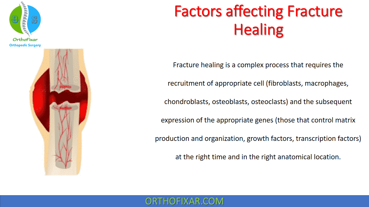 Factors Affecting Fracture Healing