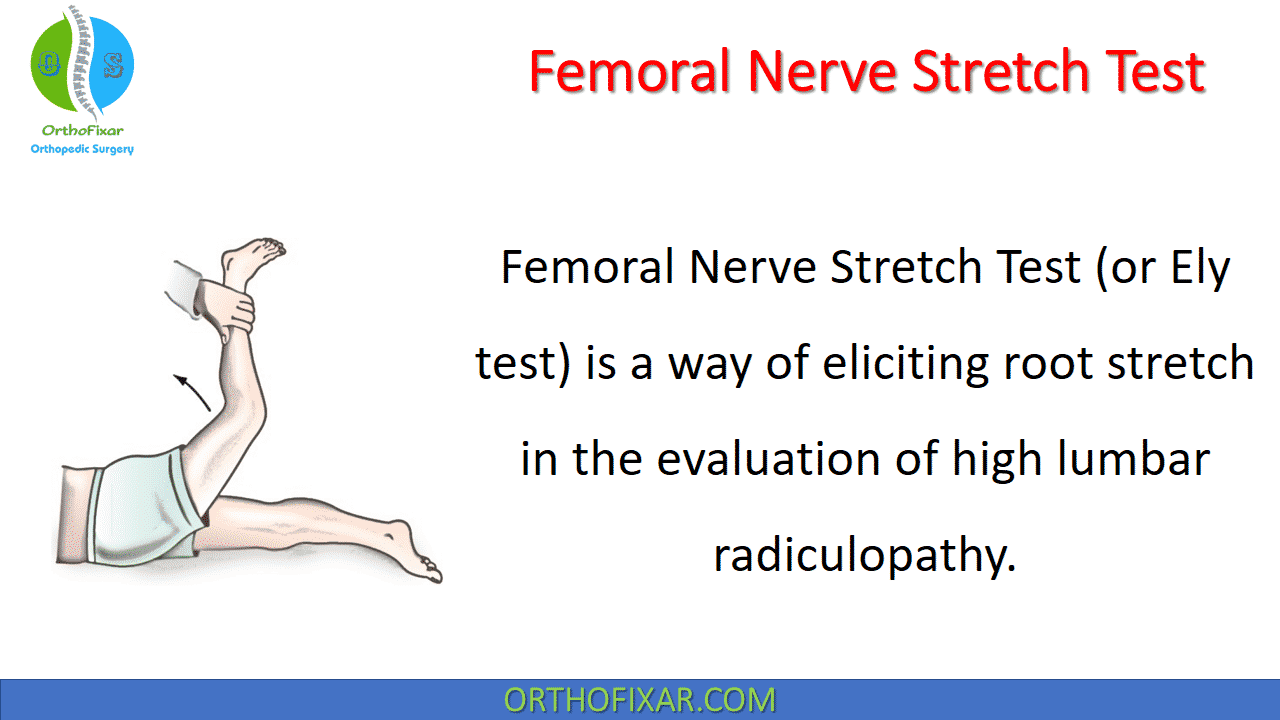 Femoral Nerve Stretch Test