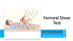 Femoral Shear Test