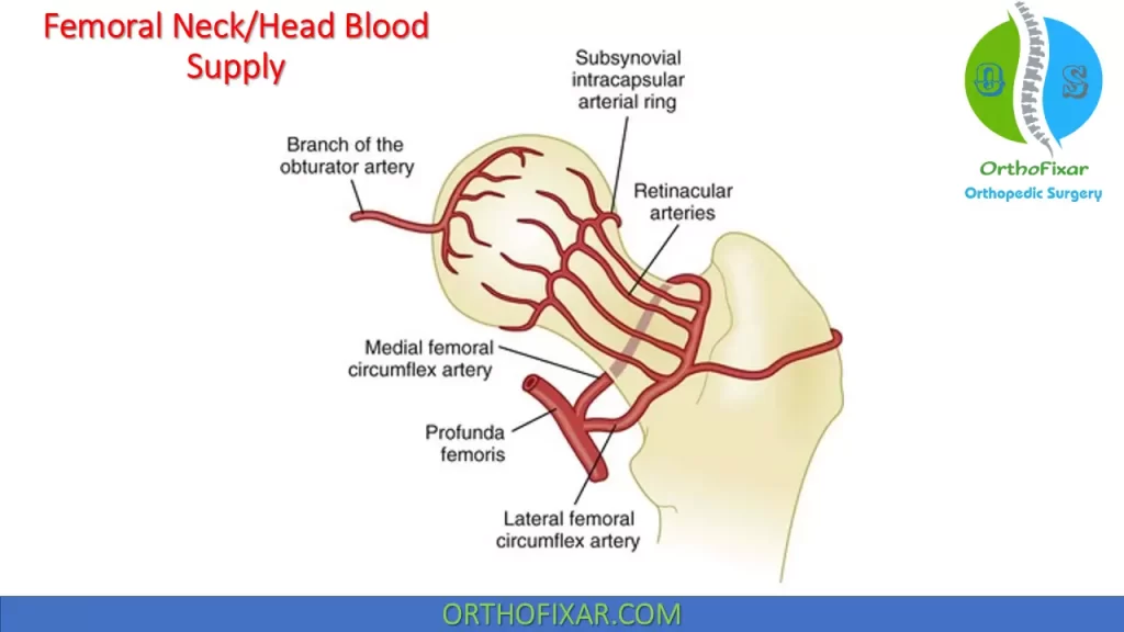 Femoral head neck blood supply