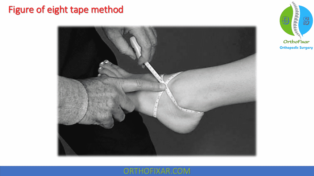 Figure of eight tape method