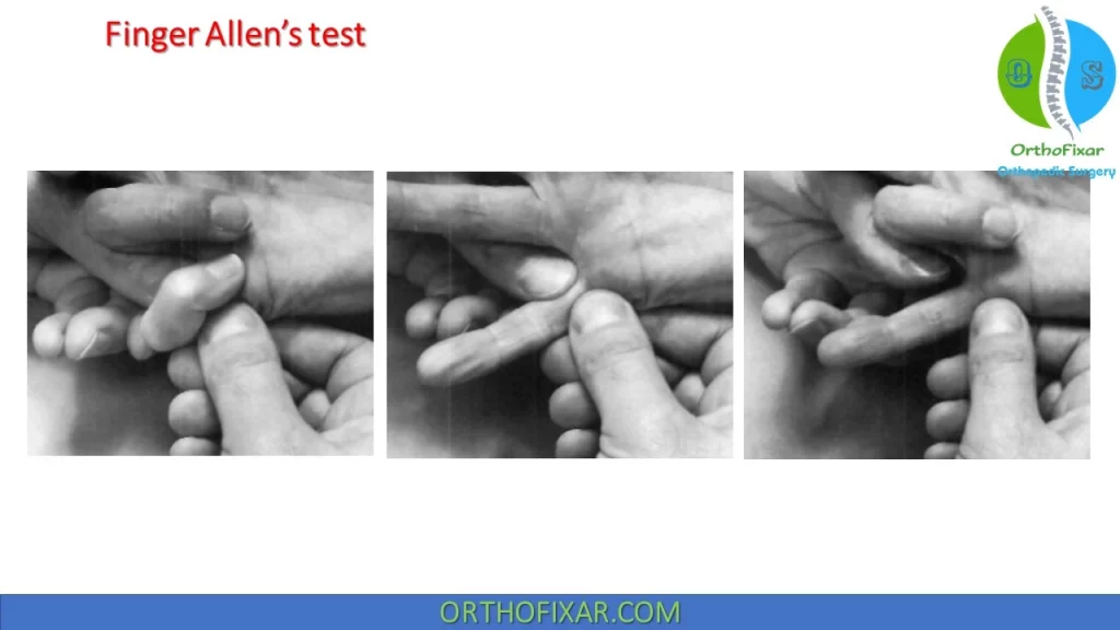 Finger Allen Test