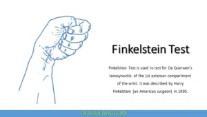 Finkelstein Test | How to Perform, Positive Test & Accuracy
