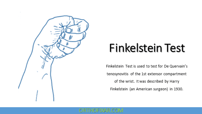  Finkelstein Test: A Step-by-Step Approach to Effective Diagnosis 