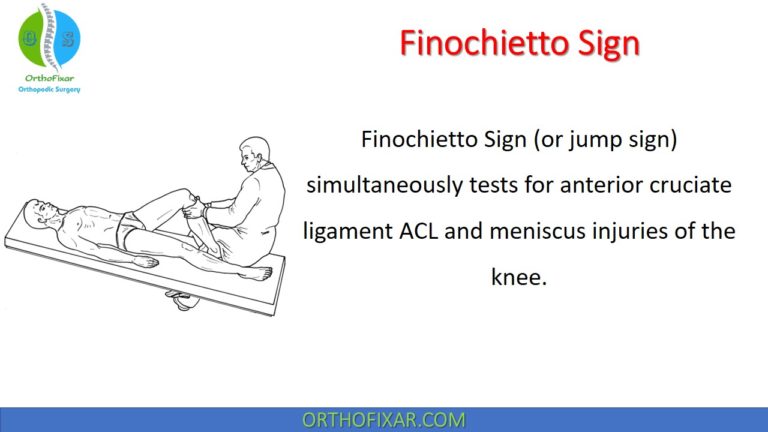 Finochietto Sign
