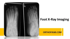 Foot X Ray Imaging
