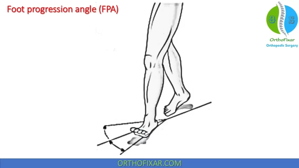 Foot progression angle (FPA)