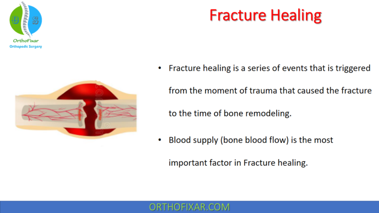 Fracture Healing