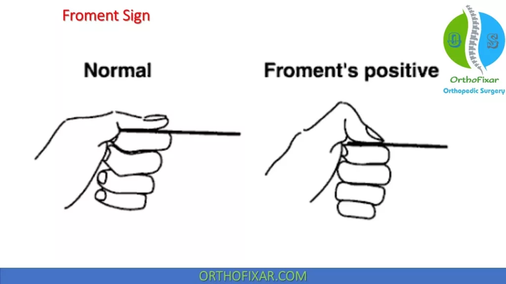 Froment-Sign-2-1024x576.webp