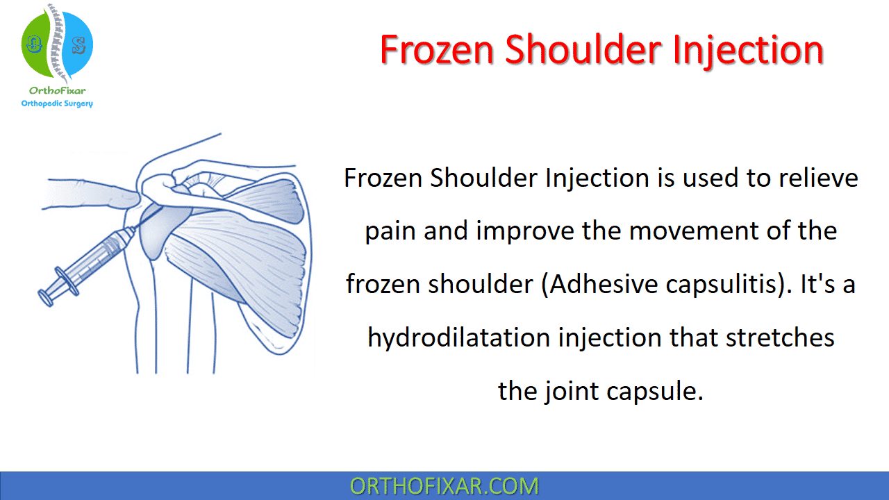 Frozen Shoulder Injection