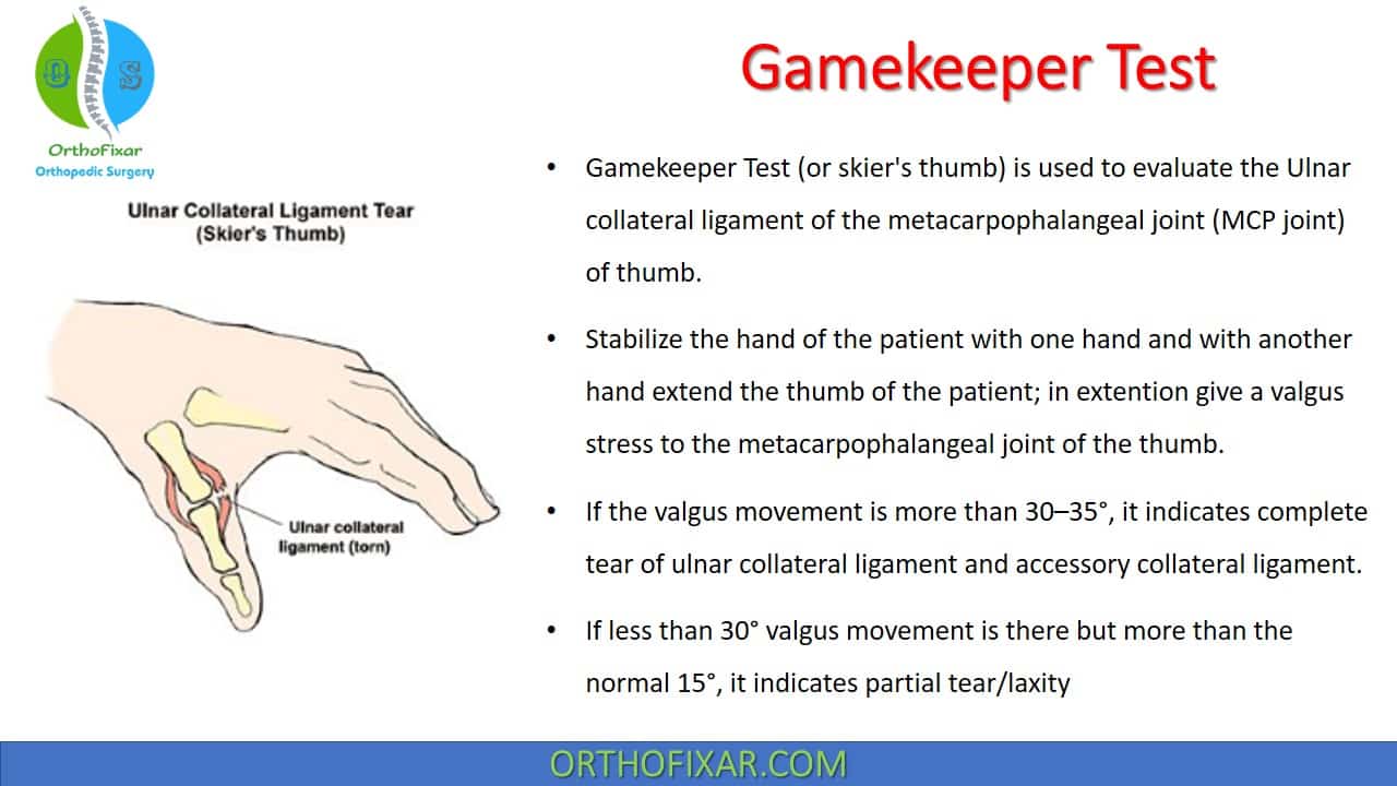  Gamekeeper Test 