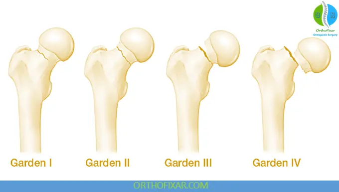 Garden Classification