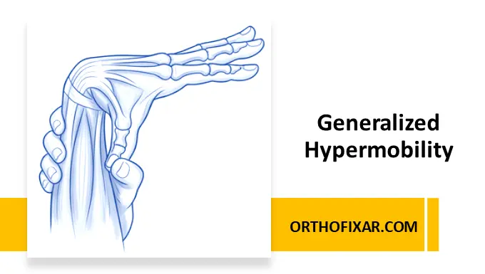 generalized hypermobility of joints