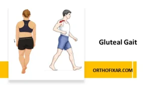 Gluteal Gait