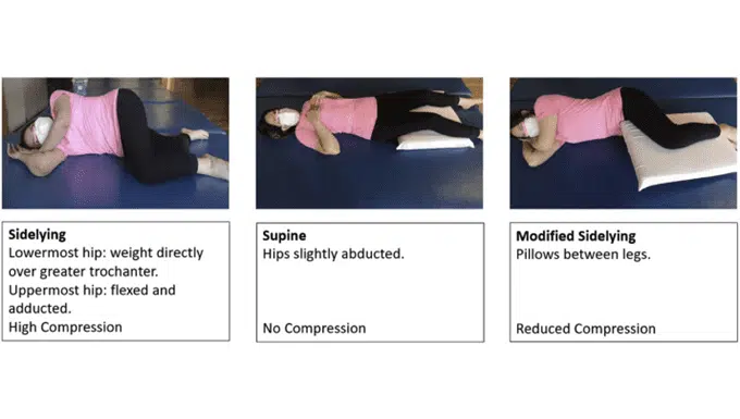 Gluteus Minimus Tear treatment rehab