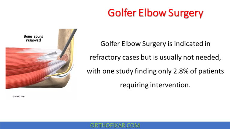 Golfer Elbow Surgery