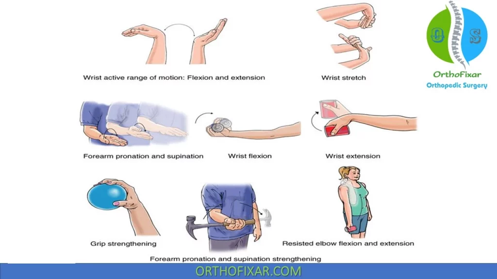 Golfer's Elbow physical therapy exercises