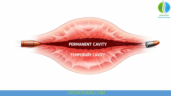 Gunshot Wound - Tissue Interaction and Cavitation