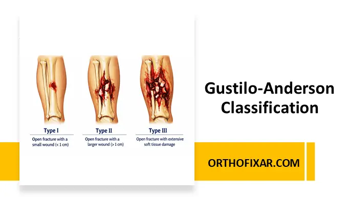 Gustilo-Anderson Classification system